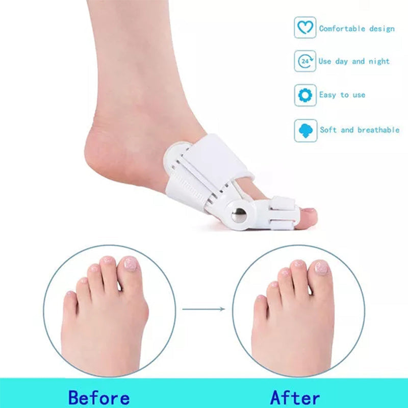 BUNION CORRECTOR FOR MEN & WOMEN