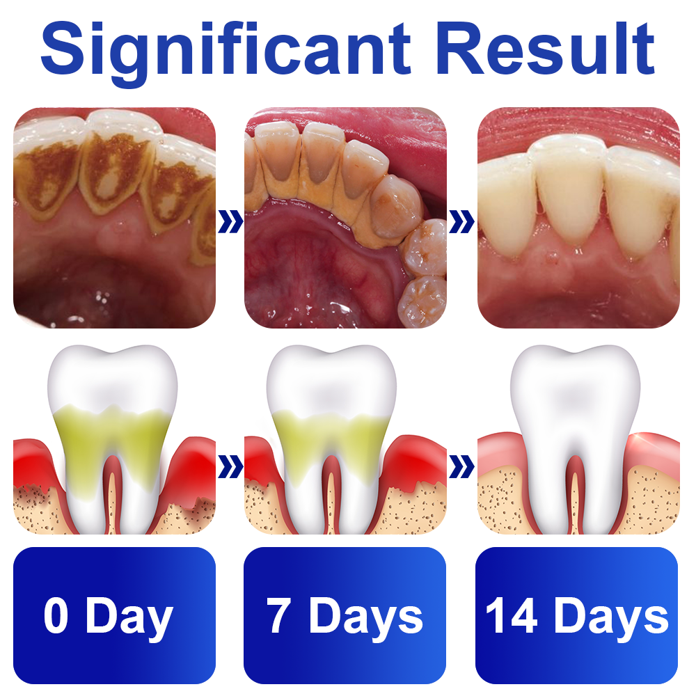 GFOUK™️ PureSmile Essence