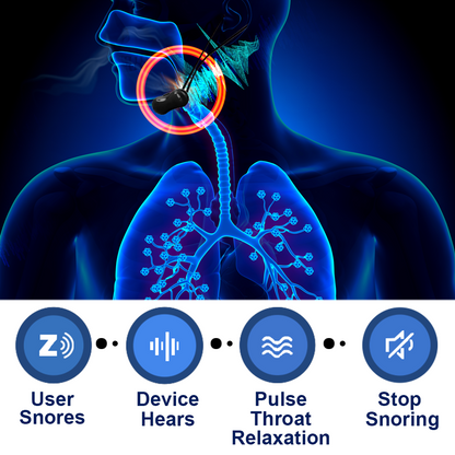 GFOUK™ Vibrating Pulse Snore Stopper