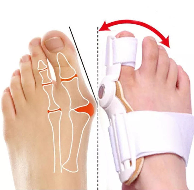 BUNION CORRECTOR FOR MEN & WOMEN