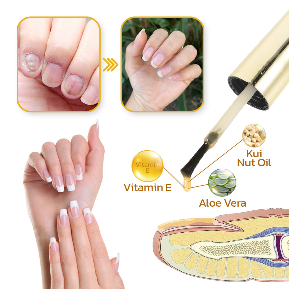 GFOUK™ VitaE Peeling Nail Serum