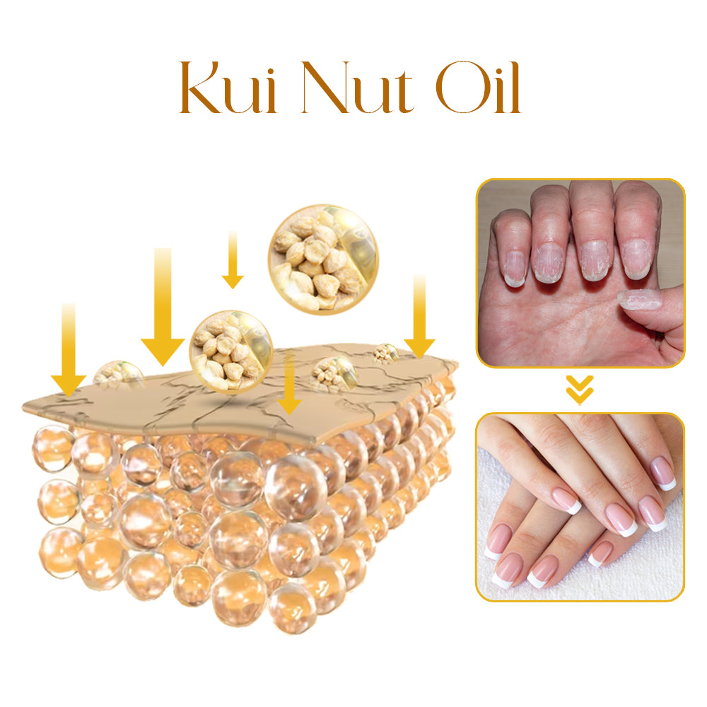 GFOUK™ VitaE Peeling Nail Serum