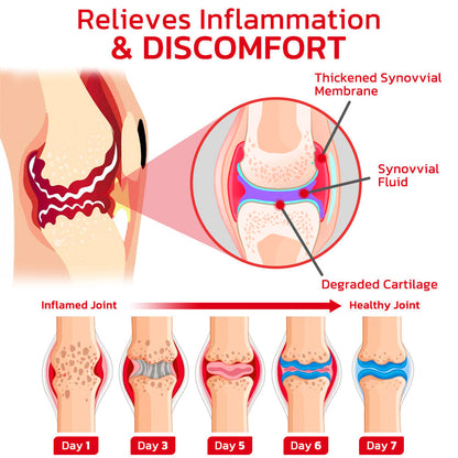 GFOUK™ JointMax Therapy and Inflammation Relief Gel