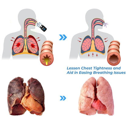 GFOUK™️ HerbalBreathe Respiratory Cleansing Aerosolizer