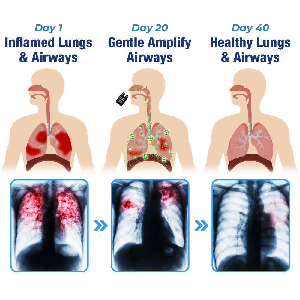 GFOUK™️ HerbalBreathe Respiratory Cleansing Aerosolizer