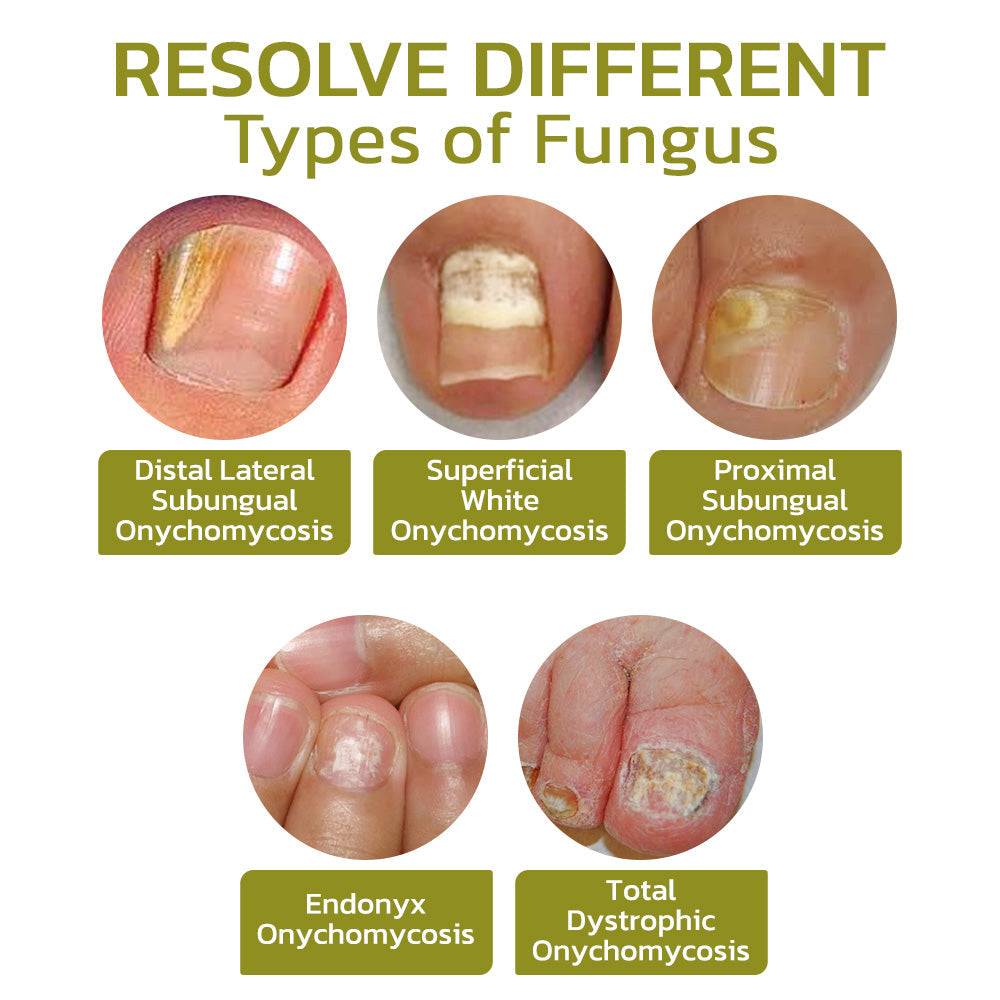 GFOUK™️ Intense Nail Growth and Strengthening Serum