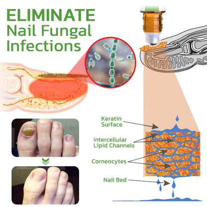 GFOUK™ 5 Days Nail Growth and Hardening Repair Roller