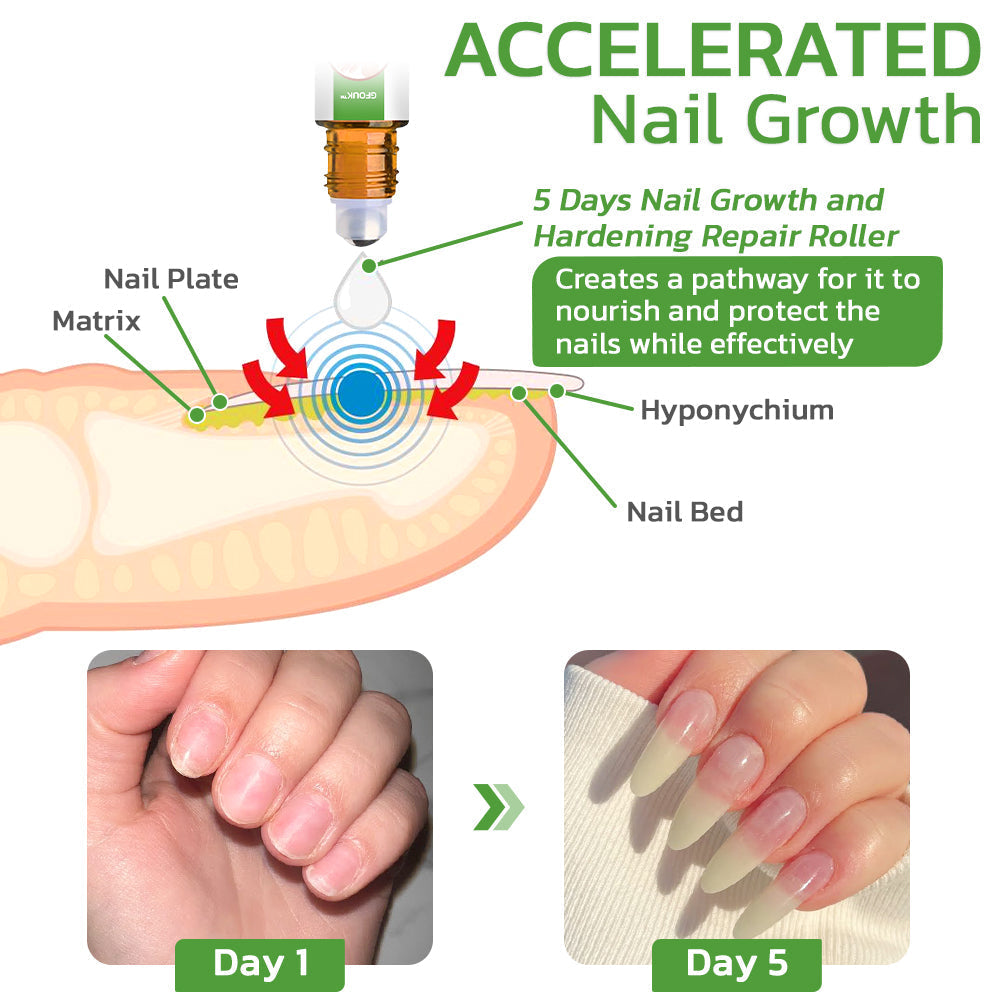 GFOUK™ 5 Days Nail Growth and Hardening Repair Roller