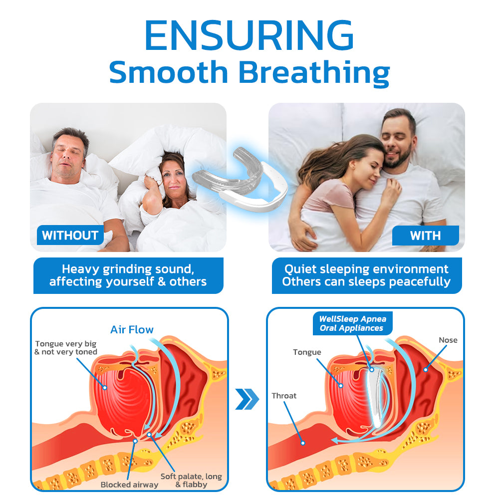 GFOUK™ WellSleep Apnea Oral Appliances