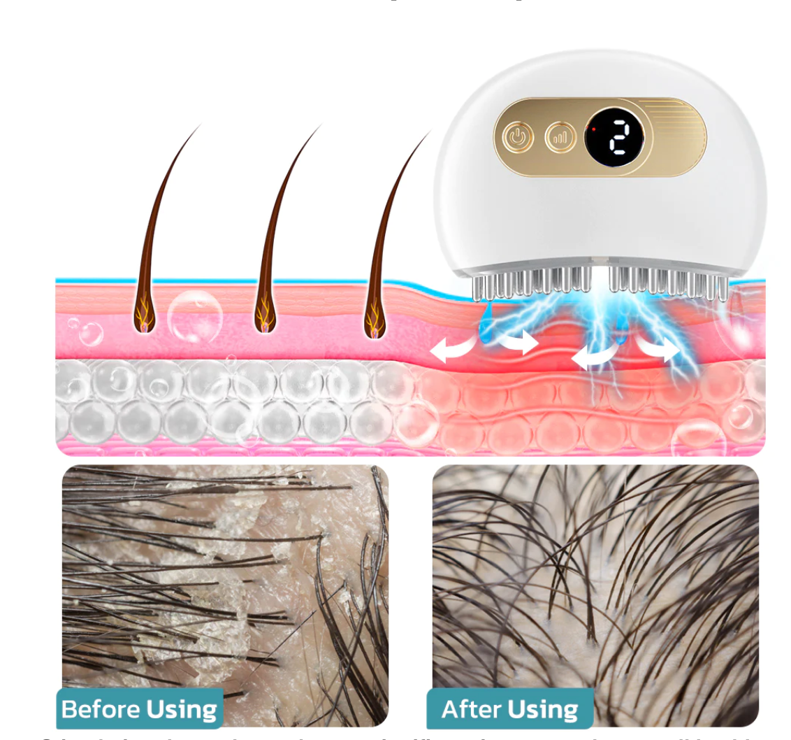 GFOUK™ EMS Nourishing Scalp Acupoint Massage Device