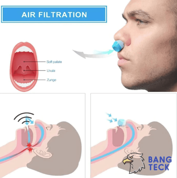 Airing: The First Hoseless, Maskless, Micro-CPAP