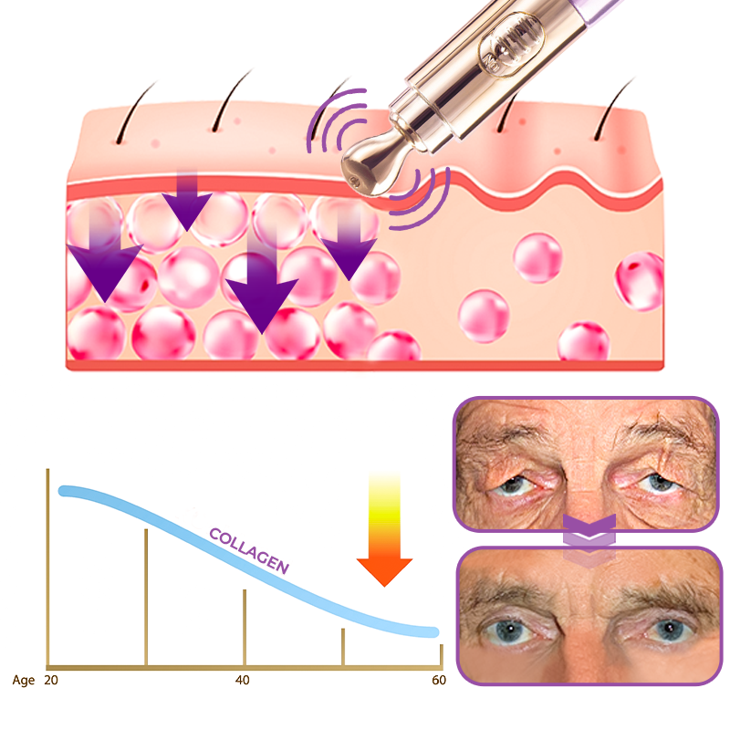 GFOUK™️ Milk Spots Therapy Electric Serum Pen