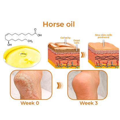 GFOUK™ Horse Oil Foot Callus Remedy Balm