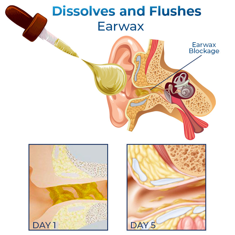 GFOUK™ Cochlear Care Oil