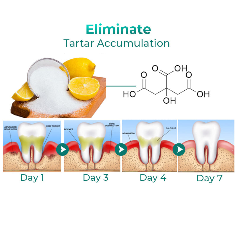 GFOUK™ Tartar Removal Foam