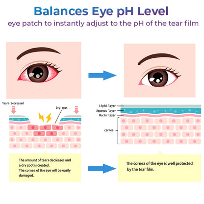 GFOUK™ Eye Therapy Patch