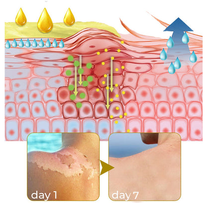 GFOUK™ Acanthosis Nigricans Peeling Oil