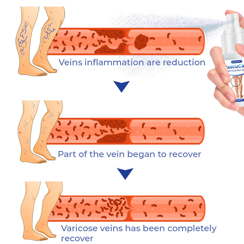 GFOUK™ VascuCare Vein Comfort Spray