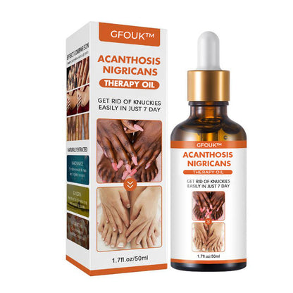 GFOUK™ Acanthosis Nigricans Therapy Oil