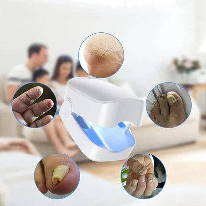 Nail Fungus Cleaning Laser Device - Expert Revolutionary High-Efficiency Light Therapy Device For Toenail Diseases