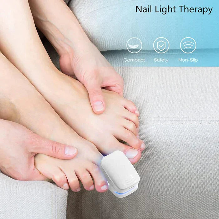 Nail Fungus Cleaning Laser Device - Expert Revolutionary High-Efficiency Light Therapy Device For Toenail Diseases